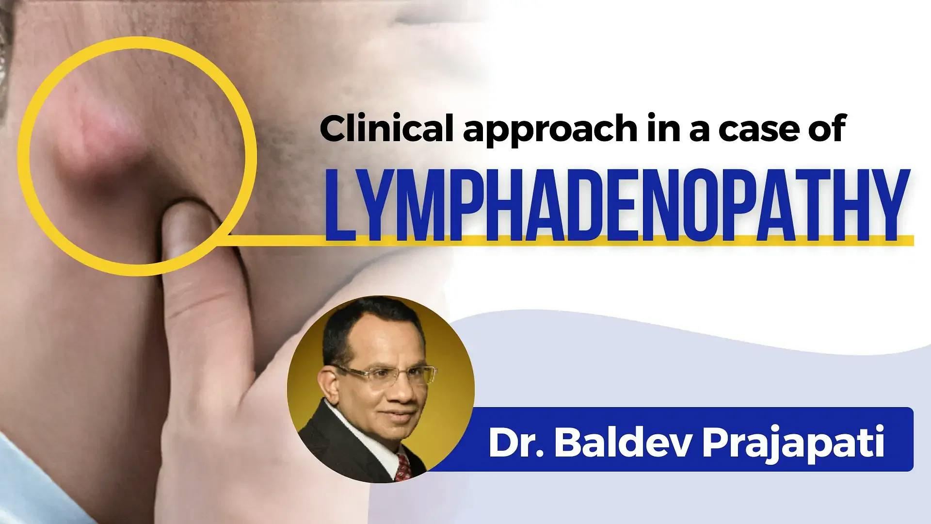 Clinical approach in a case of lymphadenopathy