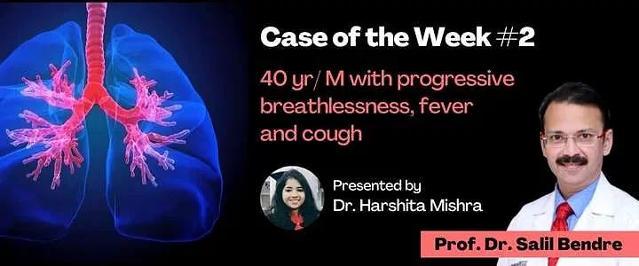 Case of the Week #2