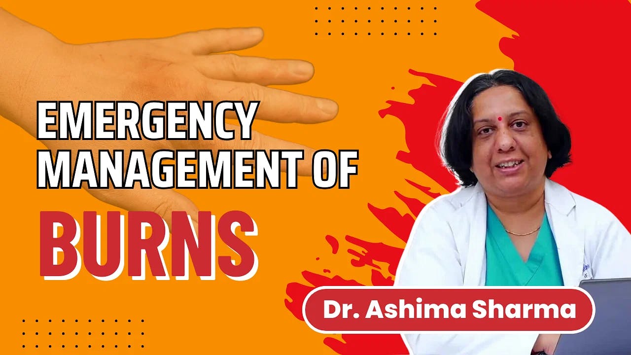 Emergency Management of Burns