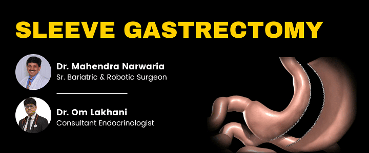 Sleeve Gastrectomy: Explained