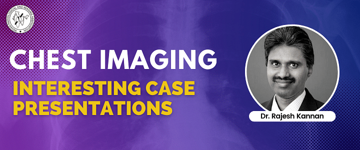 Chest Imaging - Interesting Case Presentations