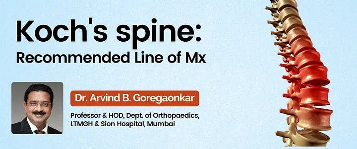 Koch's spine : Recommended Line of Mx