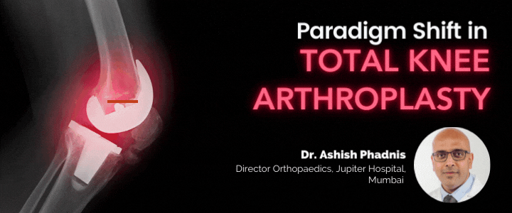 Paradigm Shift in Total Knee Arthroplasty