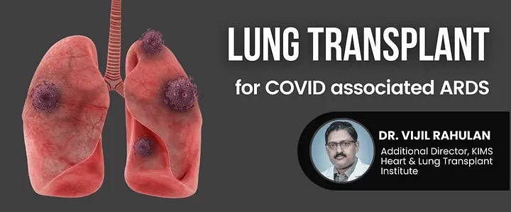 Lung Transplant for COVID associated ARDS
